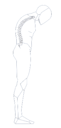 Spine recovery stage 1